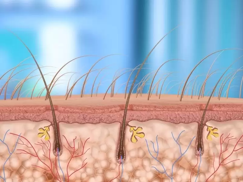 Pilonidal Sinüs
