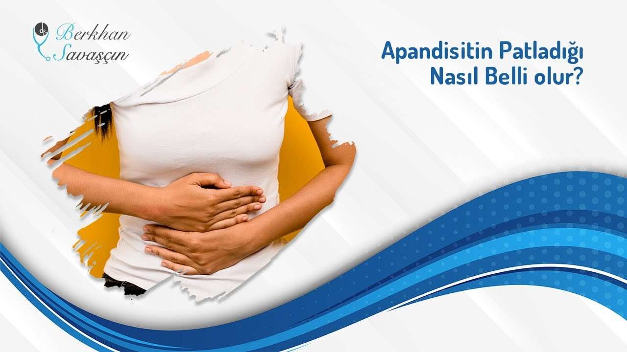 apandist,apandist patlaması,apandist belitileri