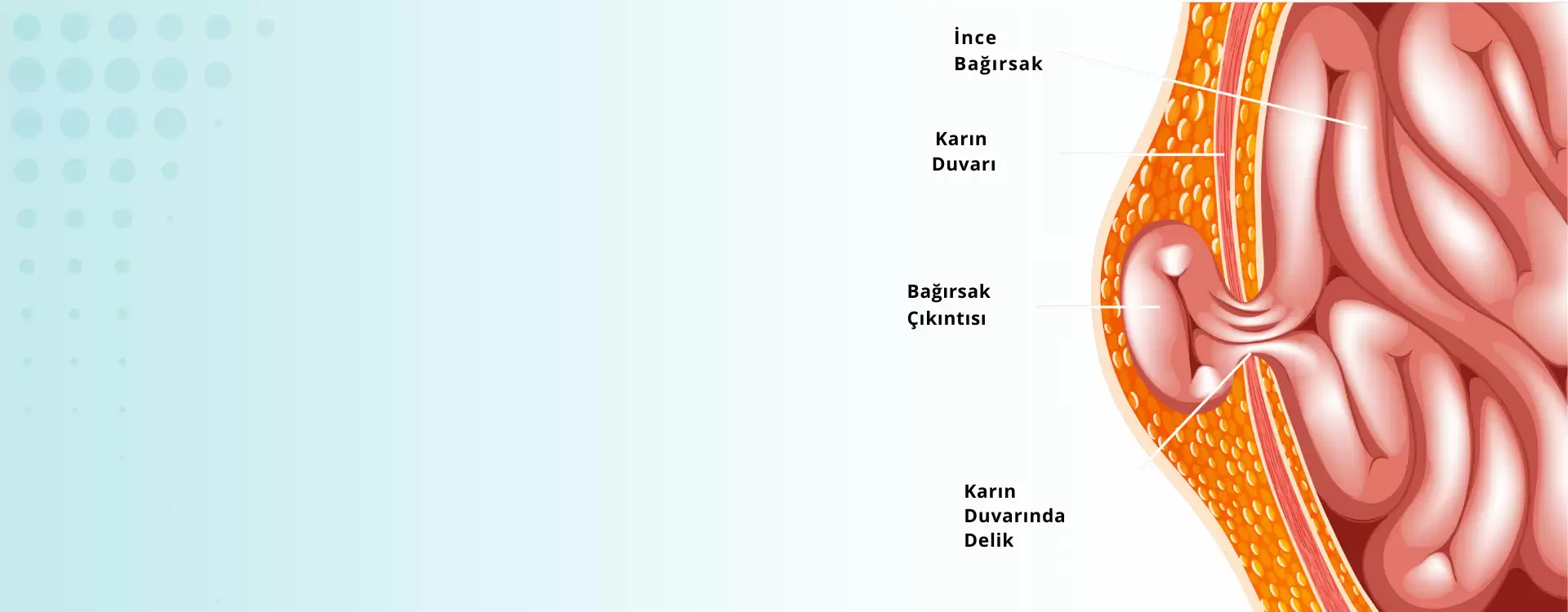 Fıtık