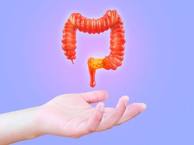 kolon-kanseri-ile-rektum-kanseri-arasindaki-fark-nedir