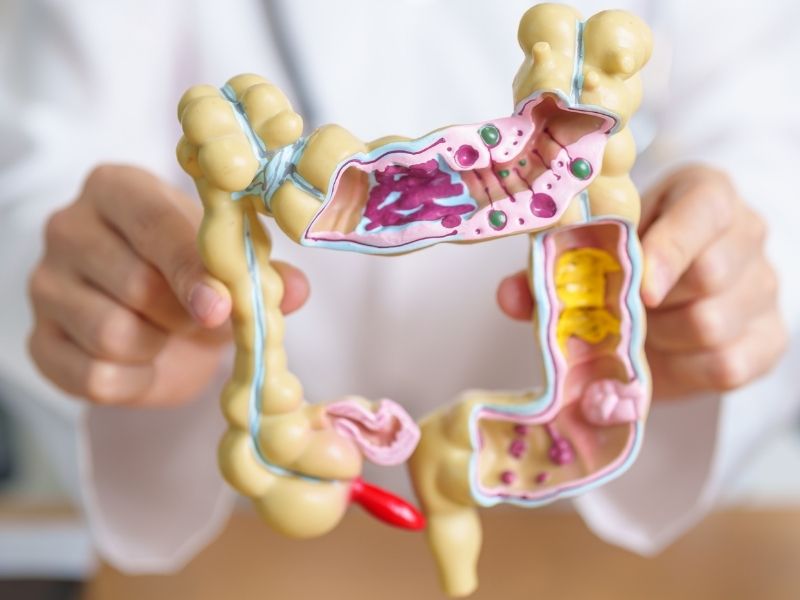 kolon-polipleri-kansere-donusur-mu