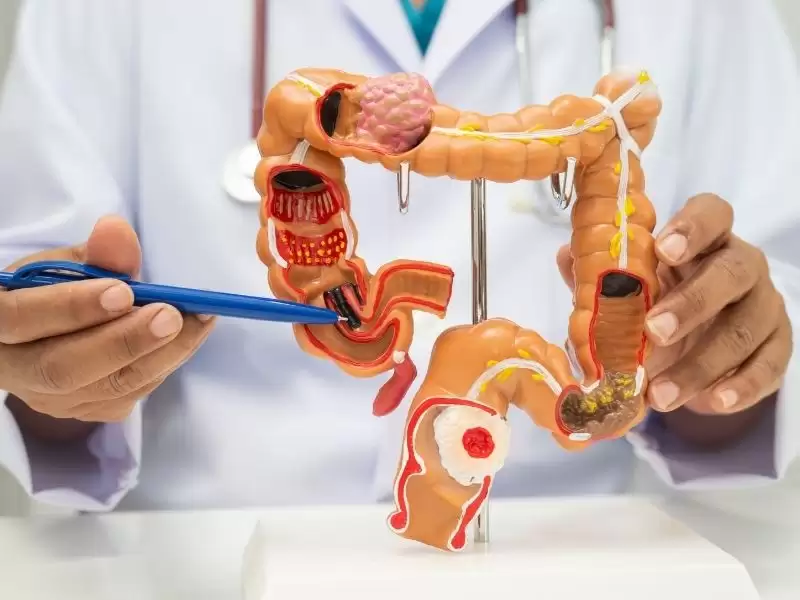 Bağırsak Hastalıkları Nelerdir