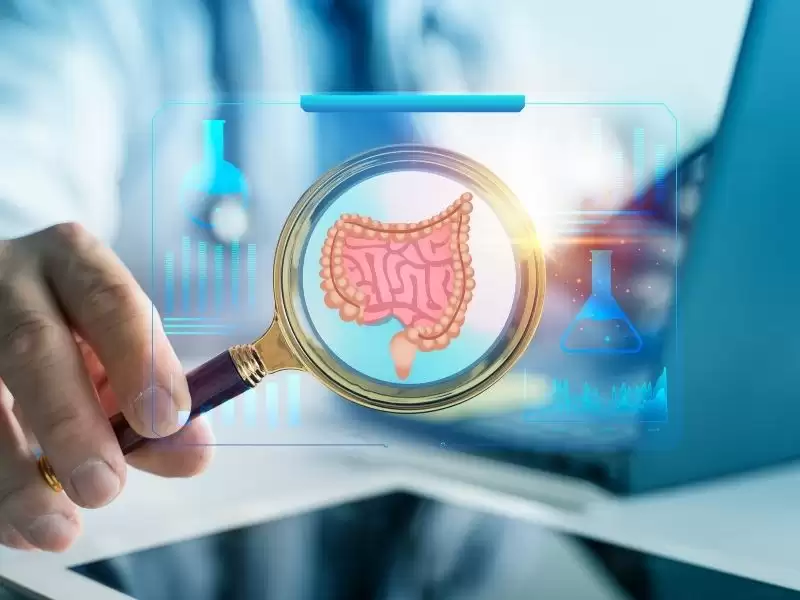 Kolon Kanseri Nedenleri